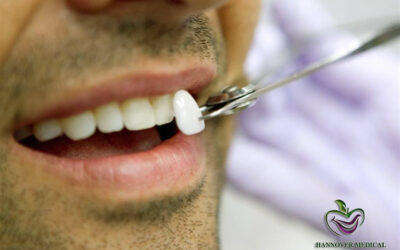 косметические коронки против виниров