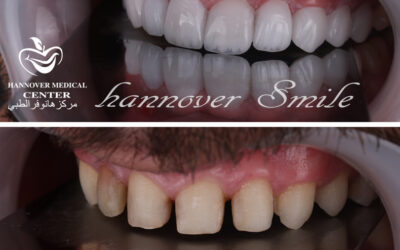 лучшая голливудская улыбка в дубае