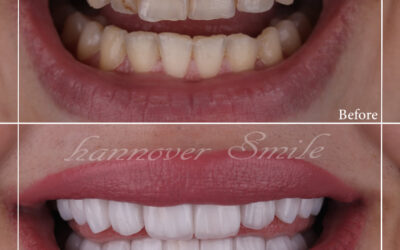 好莱坞微笑牙医