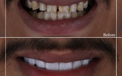 ortho تقويم الاسنان