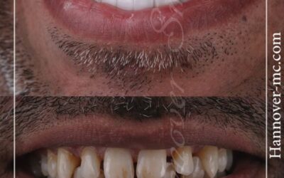 Does orthodontic mean braces?