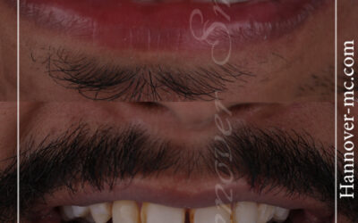 دكتور تقويم اسنان في الشارقة