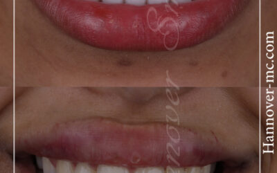 افضل فينير في الشارقة