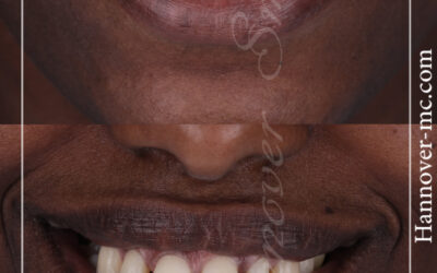 افضل مركز لازالة الشعر بالليزر في الشارقة