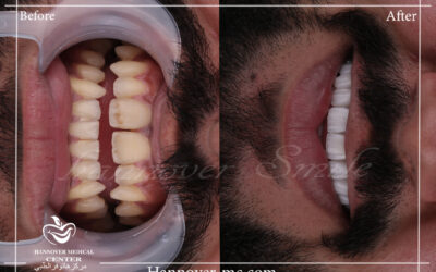 hollywood smiles dentist