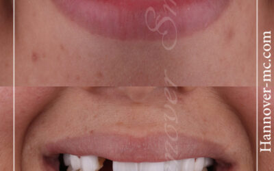 ازالة الشعر بالليزر بالشارقة