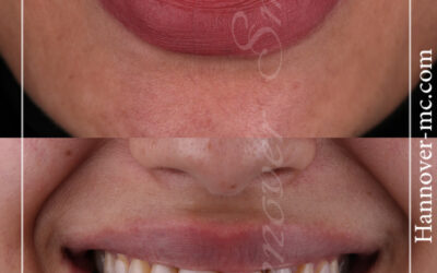 عيادات ازالة الشعر بالليزر في الشارقة