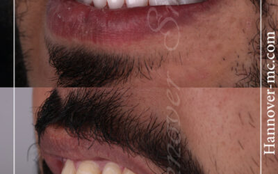 مراكز ازالة الشعر بالليزر في الشارقة