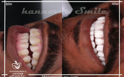 cheapest laser clinic