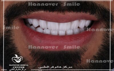 dentist hollywood smile