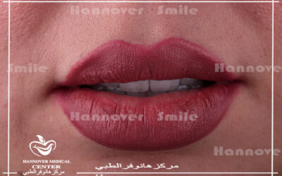 سر جمال #الإبتسامة هو جمال الأسنان