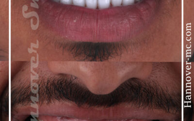 طبيب اسنان اطفال في الامارات