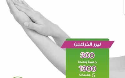 تجميل الاسنان الامامية