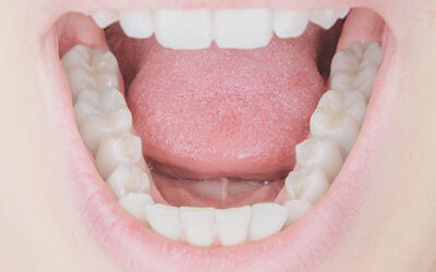 Should I go to the dentist when I am pregnant?