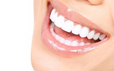 альтернатива зубным коронкам