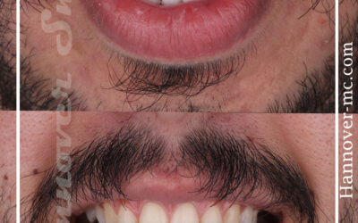 ابتسامة هيليود