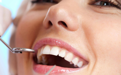 Teeth whitening dentist
