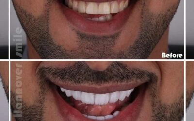 طب اسنان – أطباء وعيادات في ام القيوين