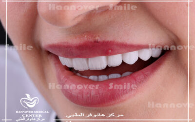 Popular Ways to Replace Missing Teeth