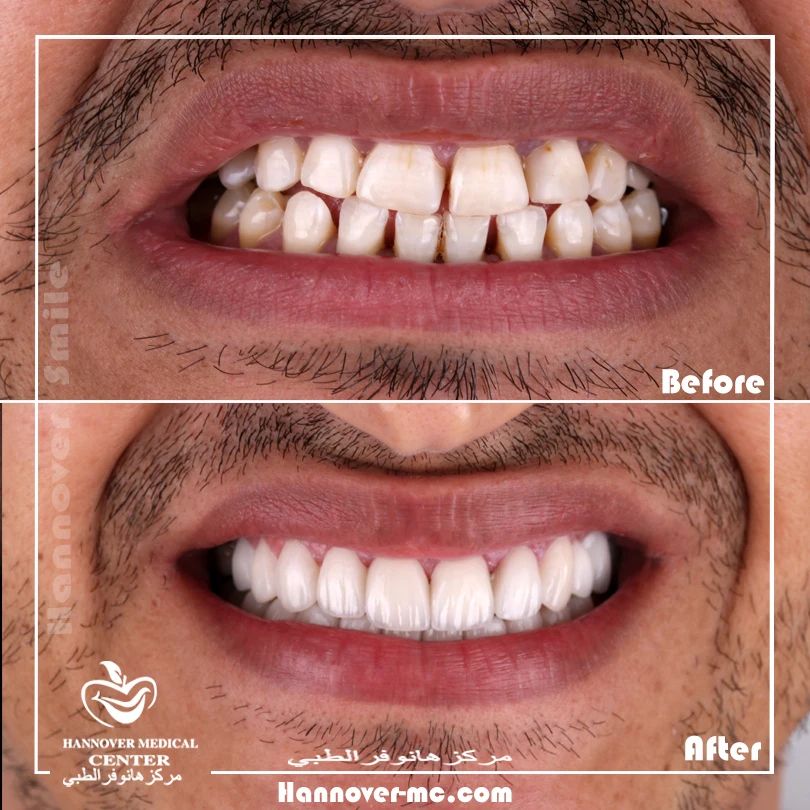 hannover-medical-center-sharjah