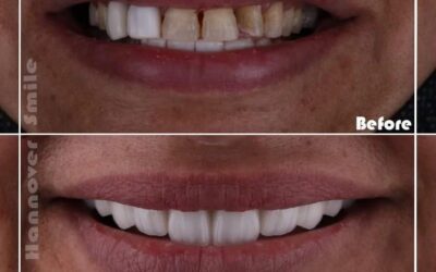 صم ابتسامتك