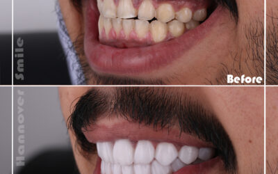 Who is an ideal candidate for dental sedation?