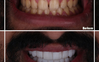 Surgeries for Mouth and Facial Trauma