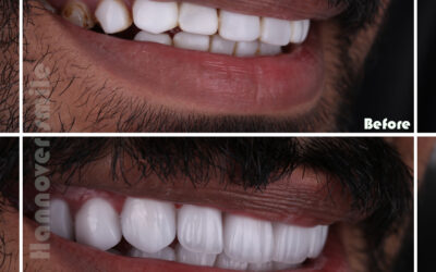 Diagnosis and Treatment Planning of Dental Ailments