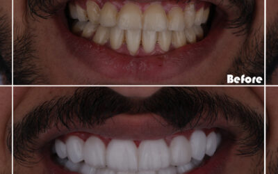 Cosmetic Dentistry Delivers More Value than Just a Simple Makeover