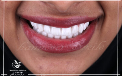 Do you want a complete transformation of your smile?