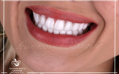 Invisible braces are made of a clear plastic