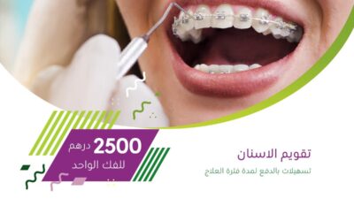 احدث طرق زراعة الاسنان , الجديد فى طب الاسنان